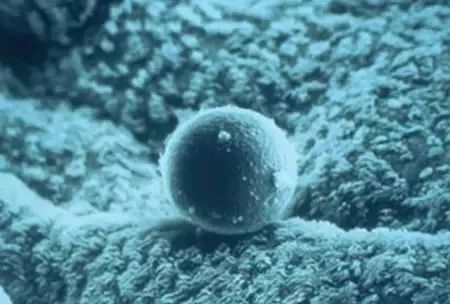 试管婴儿胚胎着床的感觉