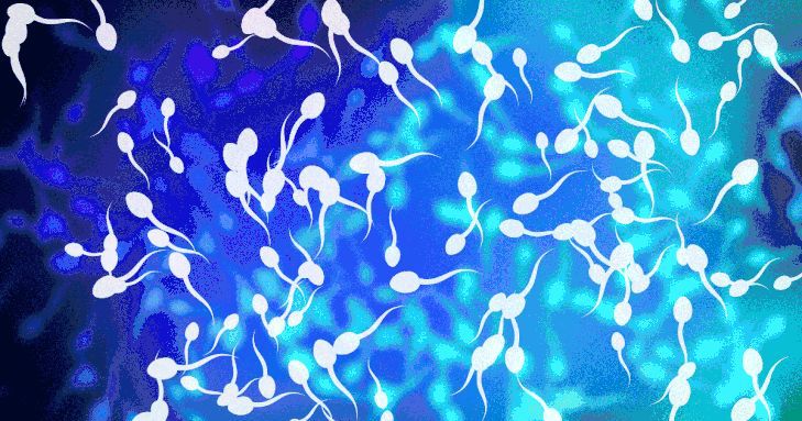 解读男性不育（无精症）遗传学染色体分析！