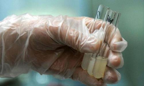 教你如何看精液化验报告单