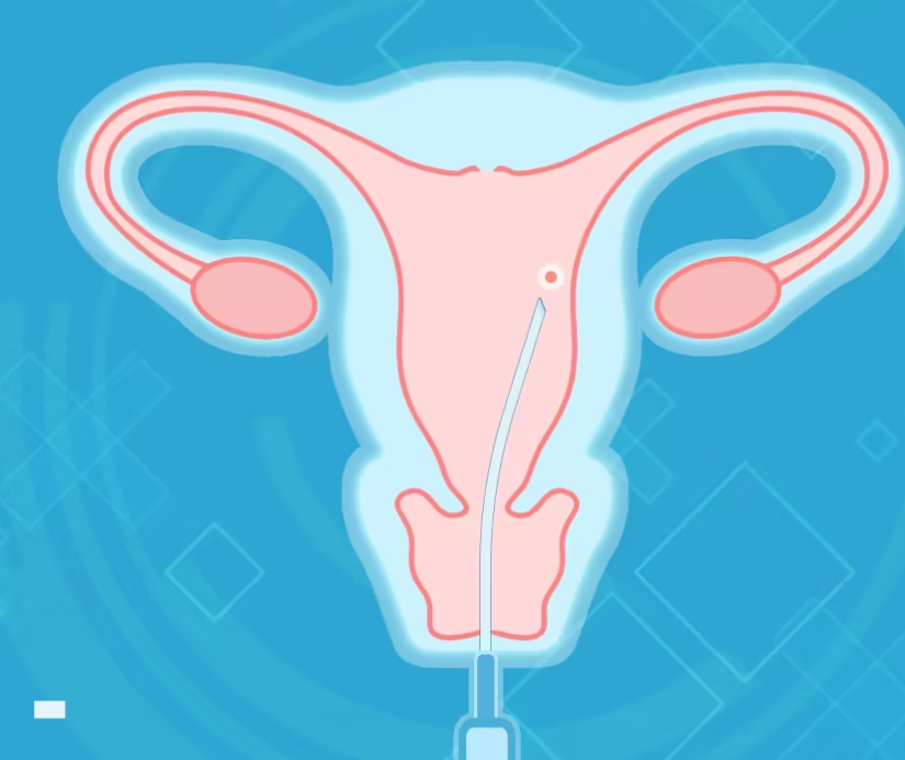 移植后多久有早孕反应？孕早期肚子隐隐作痛正常吗